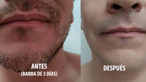 Rasuradora Philips antes y despues